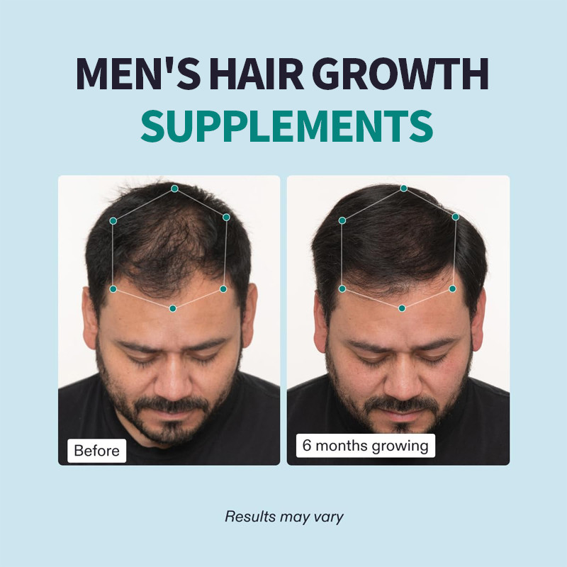 OEM Supplementi per la crescita dei capelli maschili Capelli visibilmente più spessi e copertura del cuoio capelluto Capsule per capelli maschili