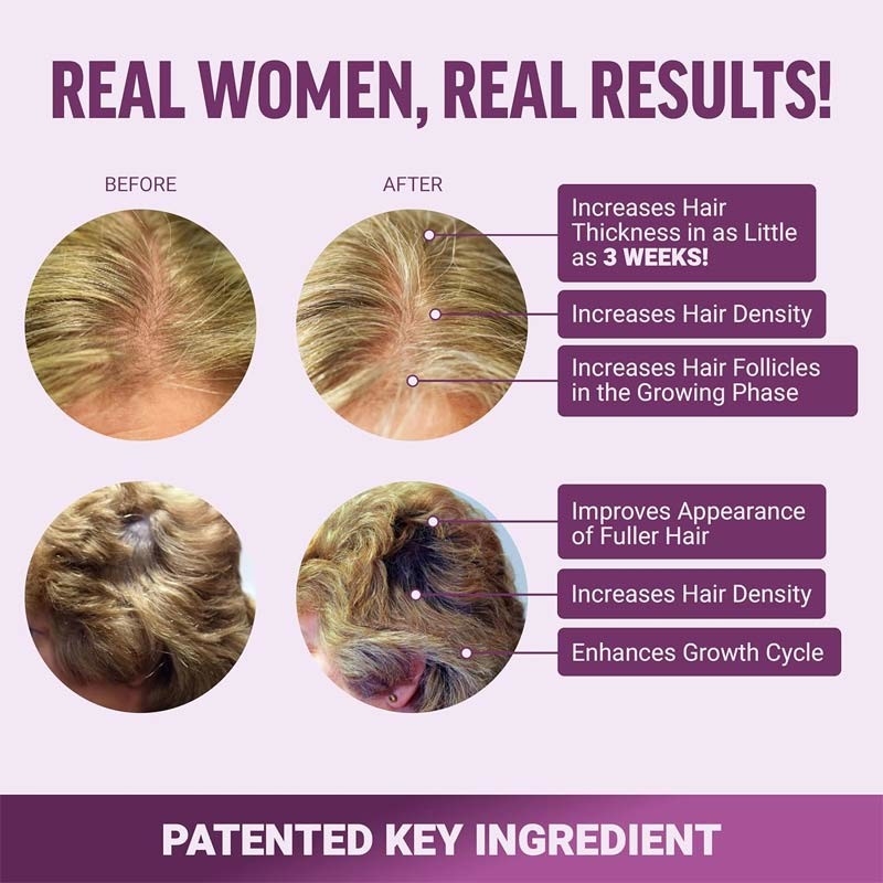 Acceleratore di crescita dei capelli Gomme per masticare morbide Gomme per la crescita dei capelli Gomme per la forza dei capelli
