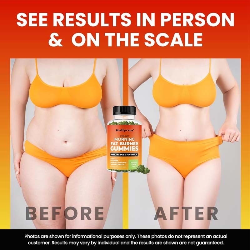 2024 Fabbrica Vendita Calda Morto Fat Burner gomme Gestione del Peso per Donne e Uomini