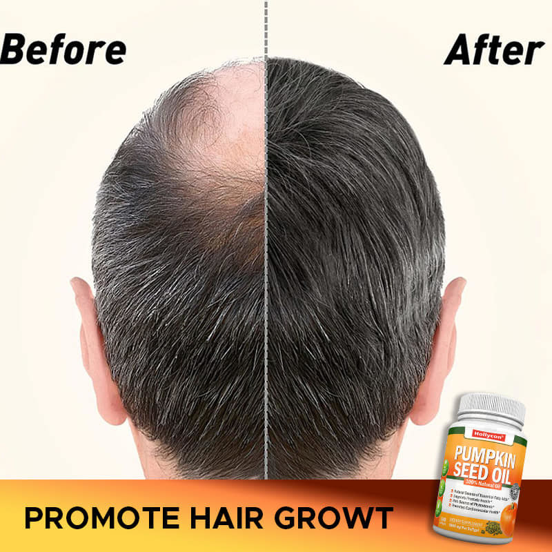 Olio di semi di zucca di fabbrica Softgels Capelli Proteine della prostata Salute delle articolazioni Omega-3 Acidi grassi essenziali