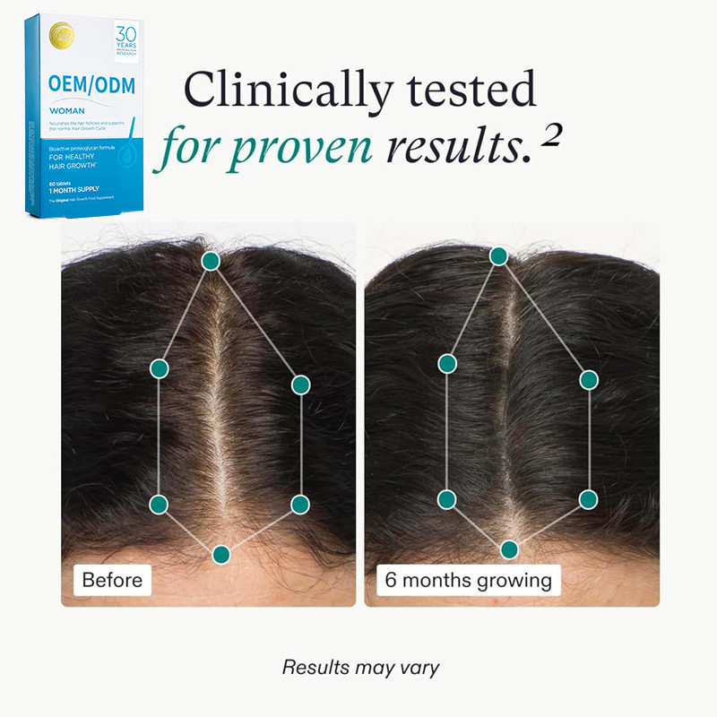 OEM Supplemento alimentare per la crescita dei capelli Pillole per la crescita naturale dei capelli