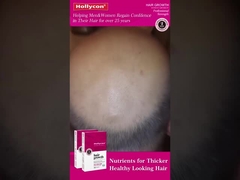 Pillole per la crescita dei capelli rossi