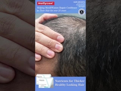 Crescita dei capelli